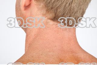 Neck texture of Alberto 0003